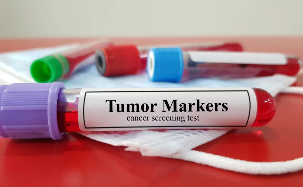 blood-test-for-cancer