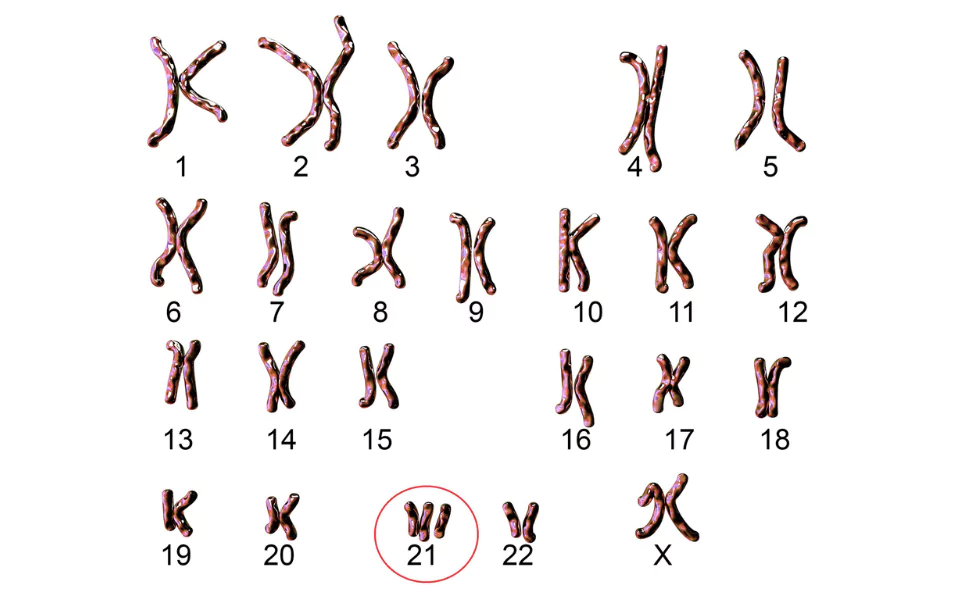 chromosomal disorders